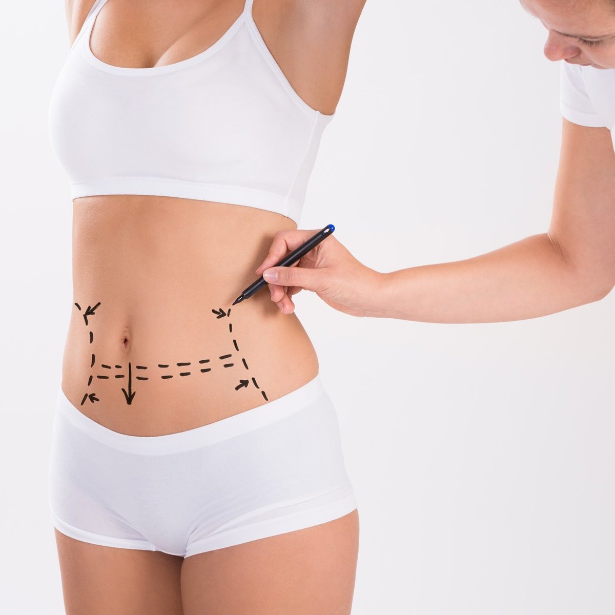 Read more about the article Lipotransfer